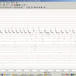 Anabat System Bat Acoustic Monitoring