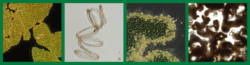 Collage of four microscopy photos of harmful algal bloom (HAB) cyanobacteria, shown in order: Microcystis wesenbergii colony, spiral-shaped Dolichospermum (Anabaena circinalis) filament, Microcystis viridis colony, and a mixed bloom of Microcystis and Anabaena from Dunns Creek.