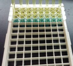 ELISA test plate with pipettes adding reagents for cyanotoxin screening in harmful algal bloom monitoring.